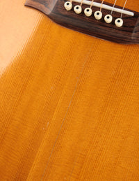 Martin M-36 (USED, 1979)