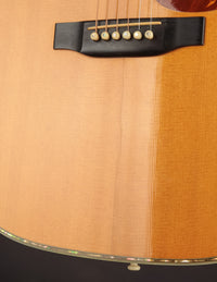Martin D-45V Brazilian (1985)